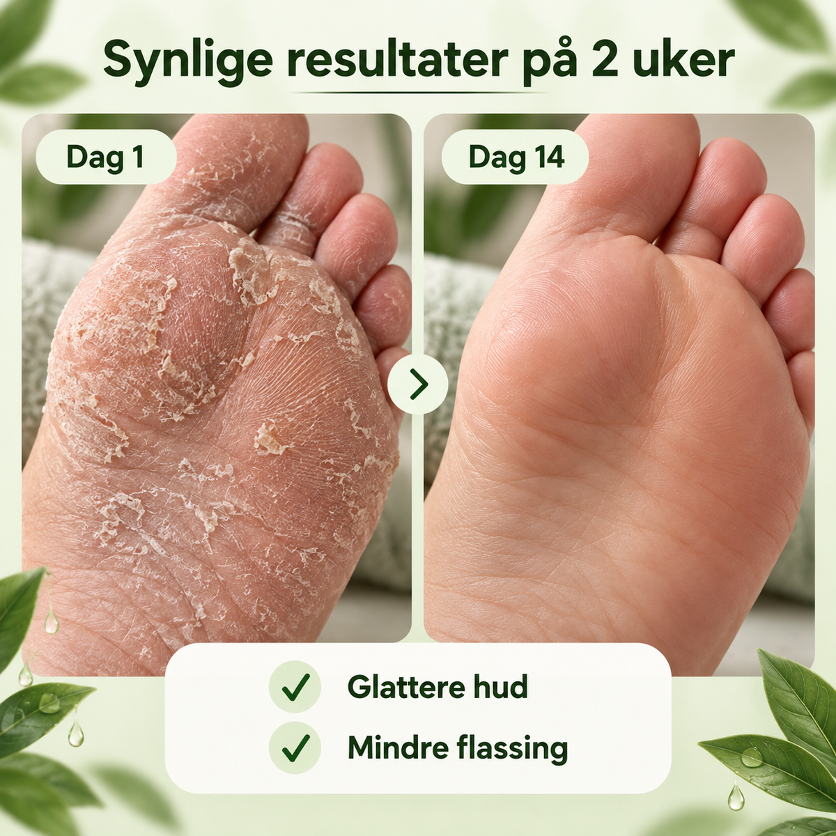 Astero™ Såpe mot Sopp