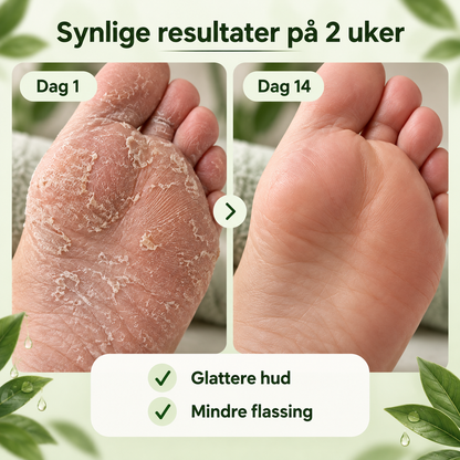 Astero™ Såpe mot Sopp
